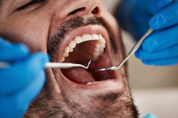Best Emergency Wisdom Teeth Removal in Caway, AR