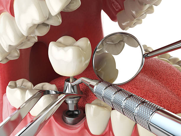 Best Emergency Broken Tooth Repair in Caway, AR